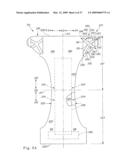 Disposable wearable absorbent articles with anchoring subsystems diagram and image