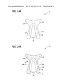 BODY ADHERING ABSORBENT ARTICLE AND METHOD FOR DONNING SUCH ARTICLE diagram and image