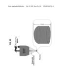 Apparatus, Systems And Techniques For Interfacing With An Eye In Laser Surgery diagram and image