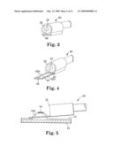 Apparatus and methods for internal surgical procedures diagram and image