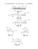 Apparatus and methods for internal surgical procedures diagram and image