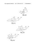 Apparatus and methods for internal surgical procedures diagram and image