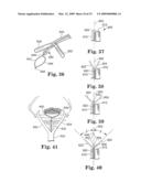 Apparatus and methods for internal surgical procedures diagram and image