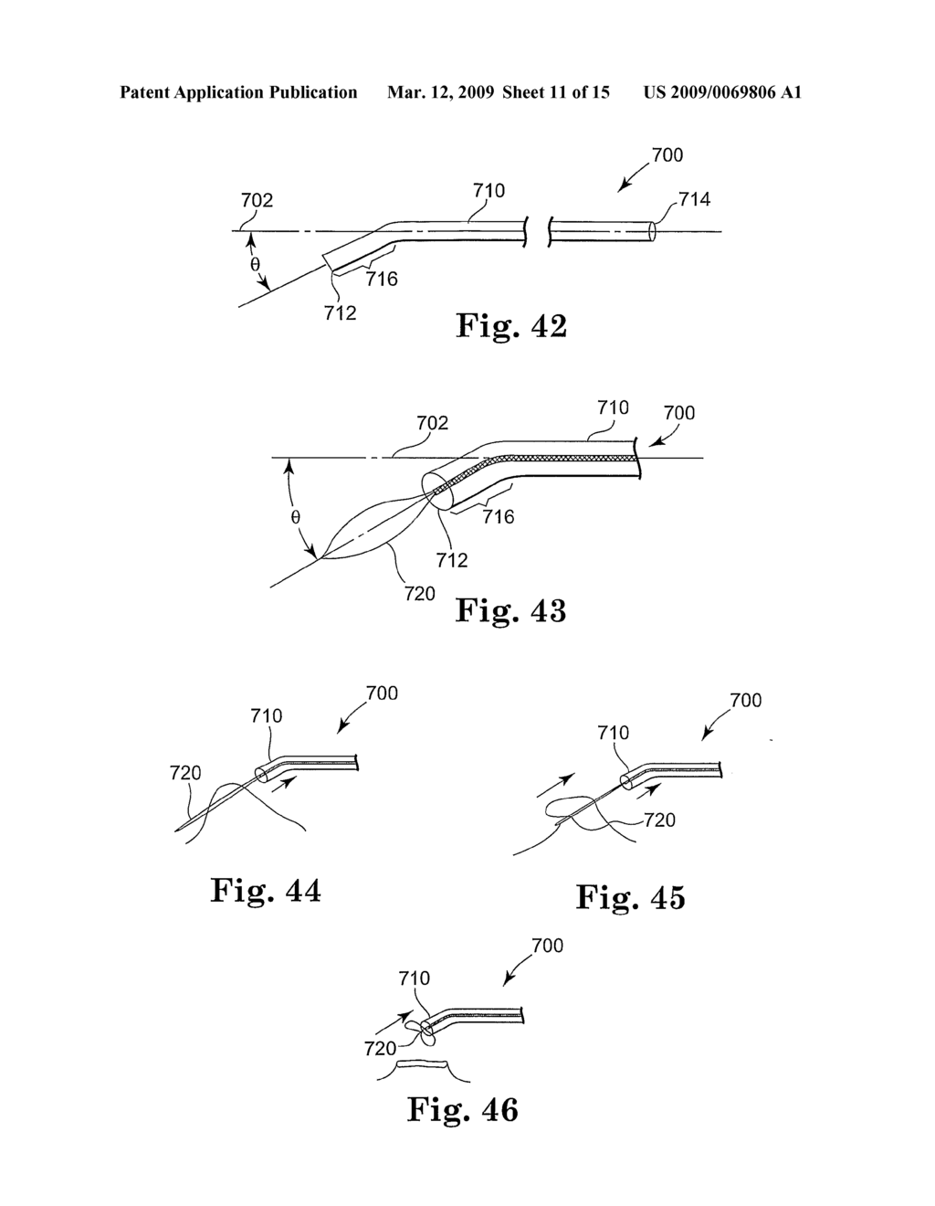 Apparatus and methods for internal surgical procedures - diagram, schematic, and image 12