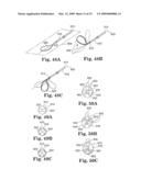 Apparatus and methods for internal surgical procedures diagram and image