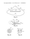 Apparatus and methods for internal surgical procedures diagram and image