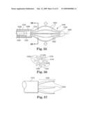 Apparatus and methods for internal surgical procedures diagram and image