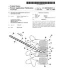 Method and composition for use in reinforcing bone diagram and image