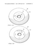 INTRASTROMAL CORNEAL MODIFICATION diagram and image