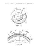 INTRASTROMAL CORNEAL MODIFICATION diagram and image