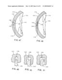 INTRASTROMAL CORNEAL MODIFICATION diagram and image