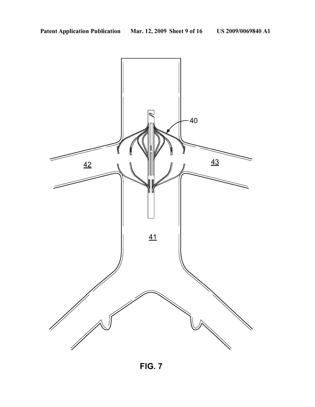 PERCUTANEOUS PERMANENT RETRIEVABLE VASCULAR FILTER - diagram, schematic, and image 10
