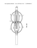 PERCUTANEOUS PERMANENT RETRIEVABLE VASCULAR FILTER diagram and image