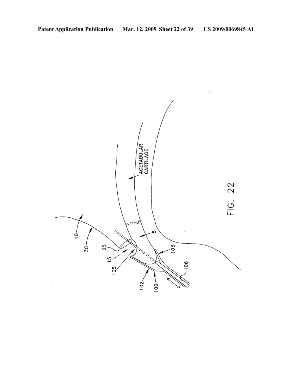 Method and apparatus for re-attaching the labrum of a hip joint - diagram, schematic, and image 23