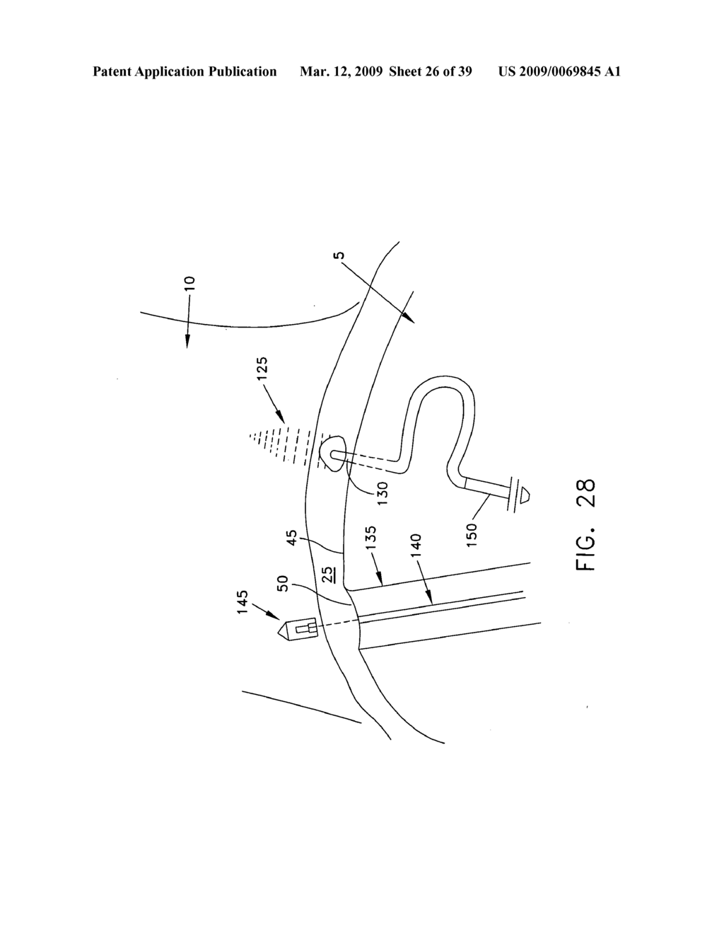 Method and apparatus for re-attaching the labrum of a hip joint - diagram, schematic, and image 27