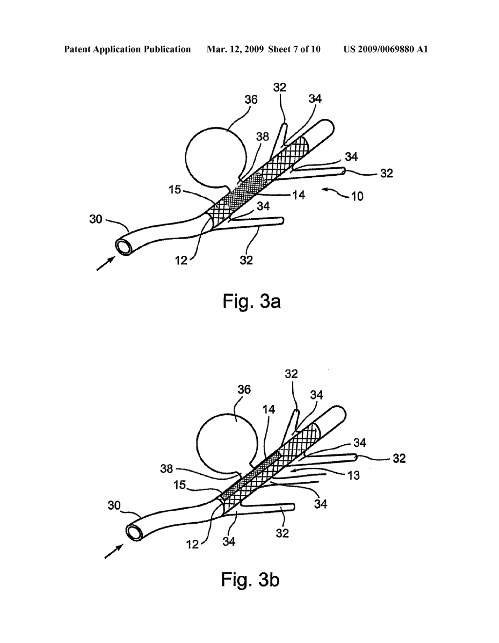 IMPLANTABLE GRAFT ASSEMBLY AND ANEURYSM TREATMENT - diagram, schematic, and image 08