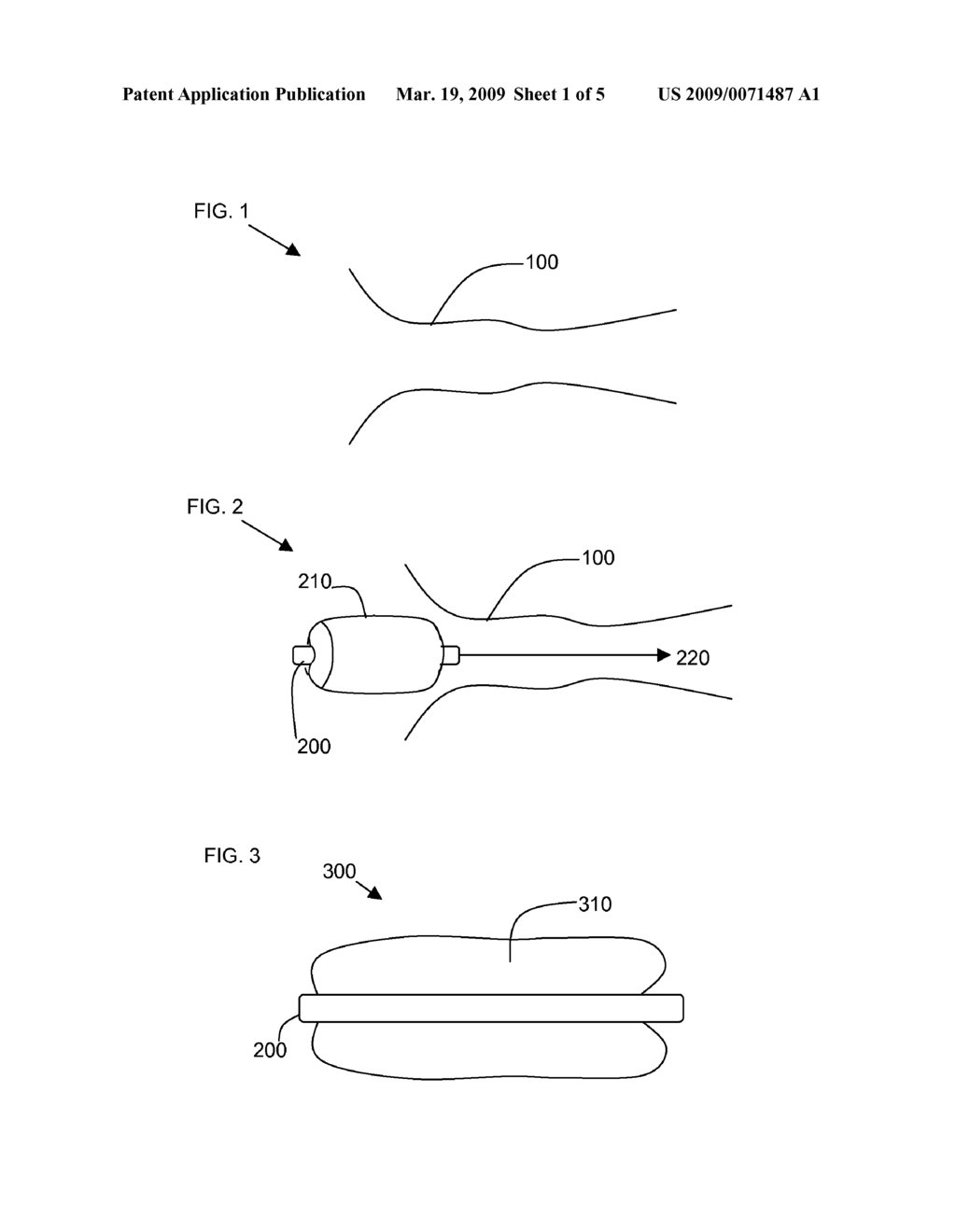 SEALING DEVICES - diagram, schematic, and image 02