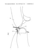 Extension hair production diagram and image