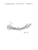 WELLBORE CONSOLIDATING TOOL FOR ROTARY DRILLING APPLICATIONS diagram and image