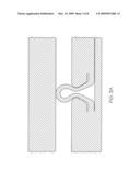 EXPANDABLE METAL-TO-METAL SEAL diagram and image