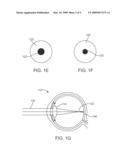 Methods and Devices for Prevention and Treatment of Myopia and Fatigue diagram and image