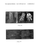 Cone-beam computed tomography with a flat-panel imager diagram and image