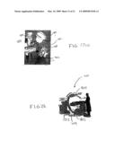 Cone-beam computed tomography with a flat-panel imager diagram and image