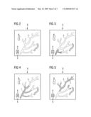 Registration method with three-dimensional representation of a vascular tree as a function of blood flow diagram and image