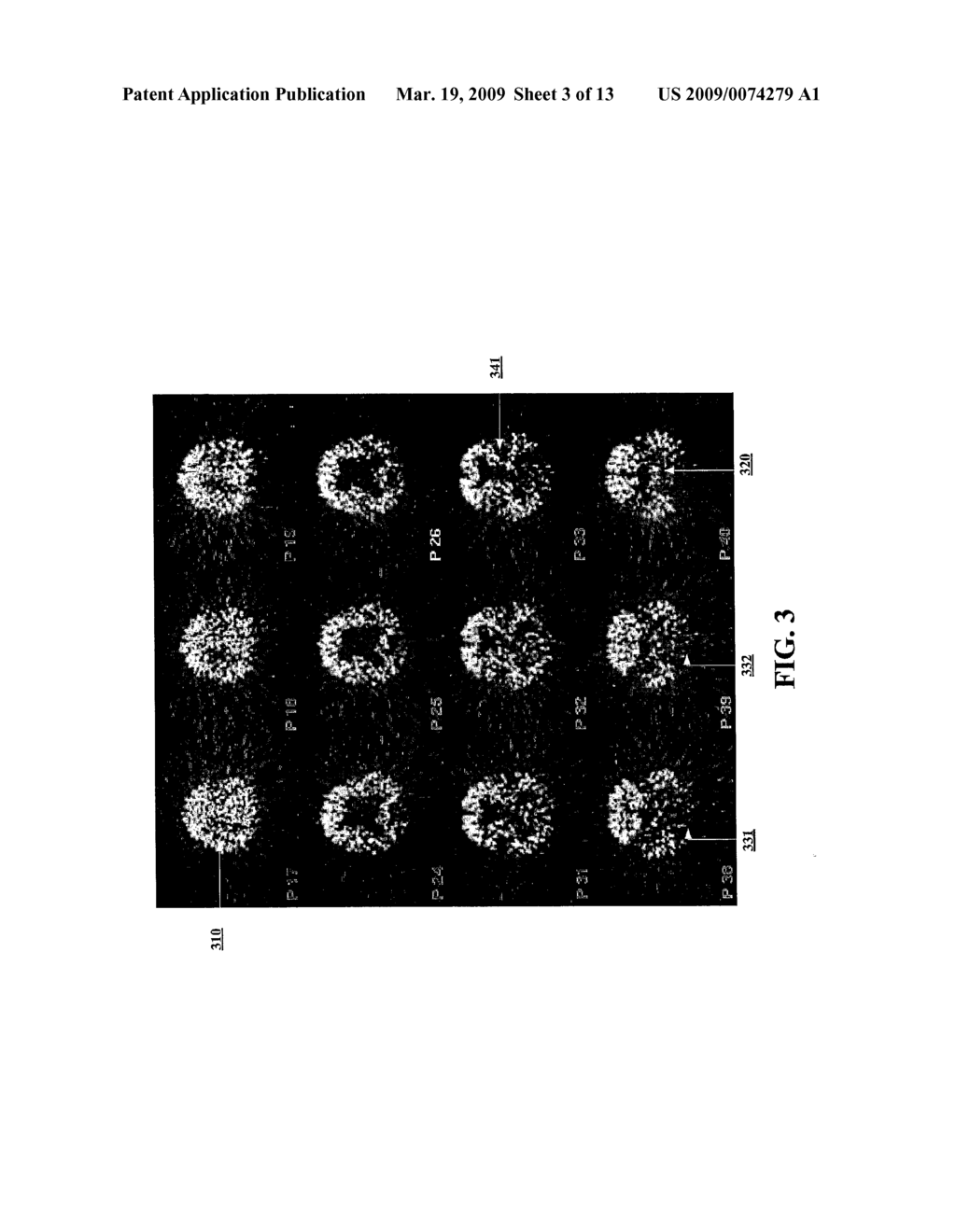 METHOD AND SYSTEM OF MULTIVARIATE ANALYSIS ON SLICE-WISE DATA OF REFERENCE STRUCTURE NORMALIZED IMAGES FOR IMPROVED QUALITY IN POSITRON EMISSION TOMOGRAPHY STUDIES - diagram, schematic, and image 04