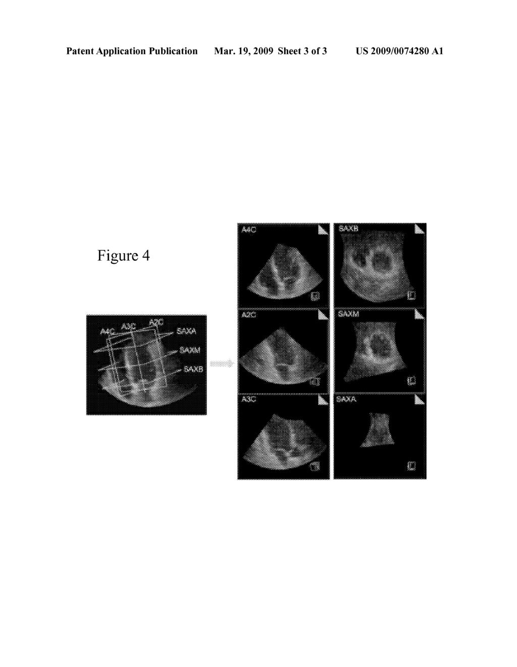 Automated Detection of Planes From Three-Dimensional Echocardiographic Data - diagram, schematic, and image 04