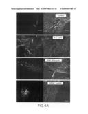 COMPOSITIONS AND METHODS FOR TREATING OCULAR DISEASES AND CONDITIONS diagram and image