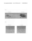 Cancer antigen and use thereof diagram and image