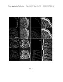 Reversible Hydrophobic Modification of Drugs for Improved Delivery to Cells diagram and image