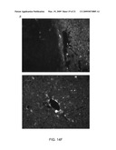 Reversible Hydrophobic Modification of Drugs for Improved Delivery to Cells diagram and image