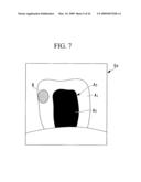 DENTAL OBSERVATION APPARATUS diagram and image