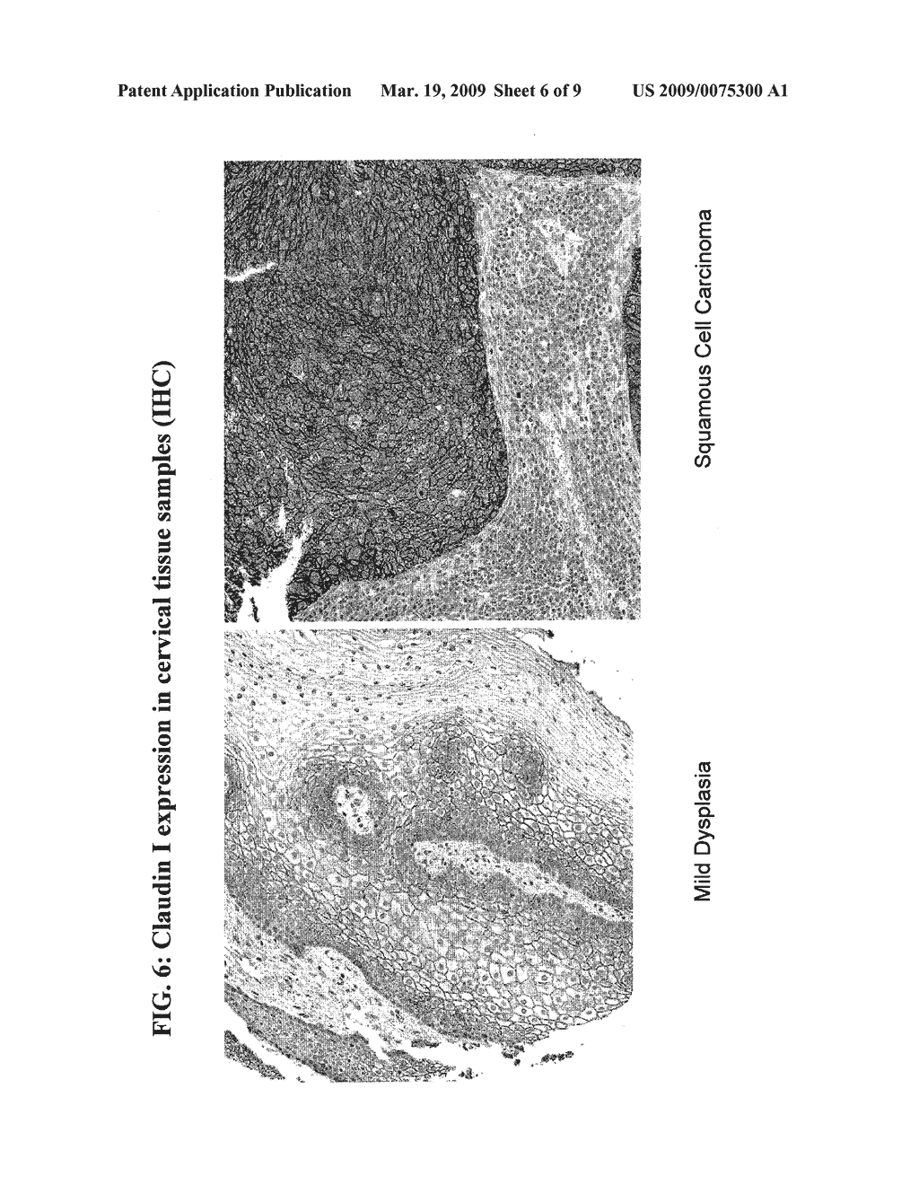 METHODS AND COMPOSITIONS FOR THE DETECTION OF CERVICAL DISEASE - diagram, schematic, and image 07