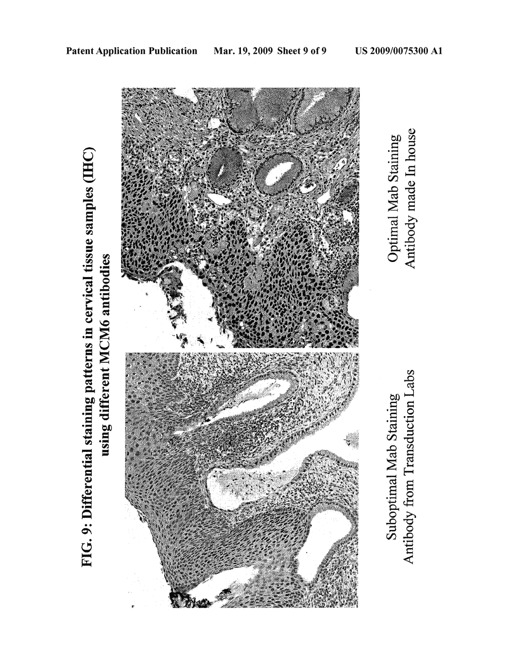 METHODS AND COMPOSITIONS FOR THE DETECTION OF CERVICAL DISEASE - diagram, schematic, and image 10