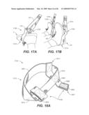 COMBINATION GRIP FOR AN EXERCISE DEVICE diagram and image