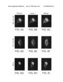 Method of treating gaucher disease diagram and image