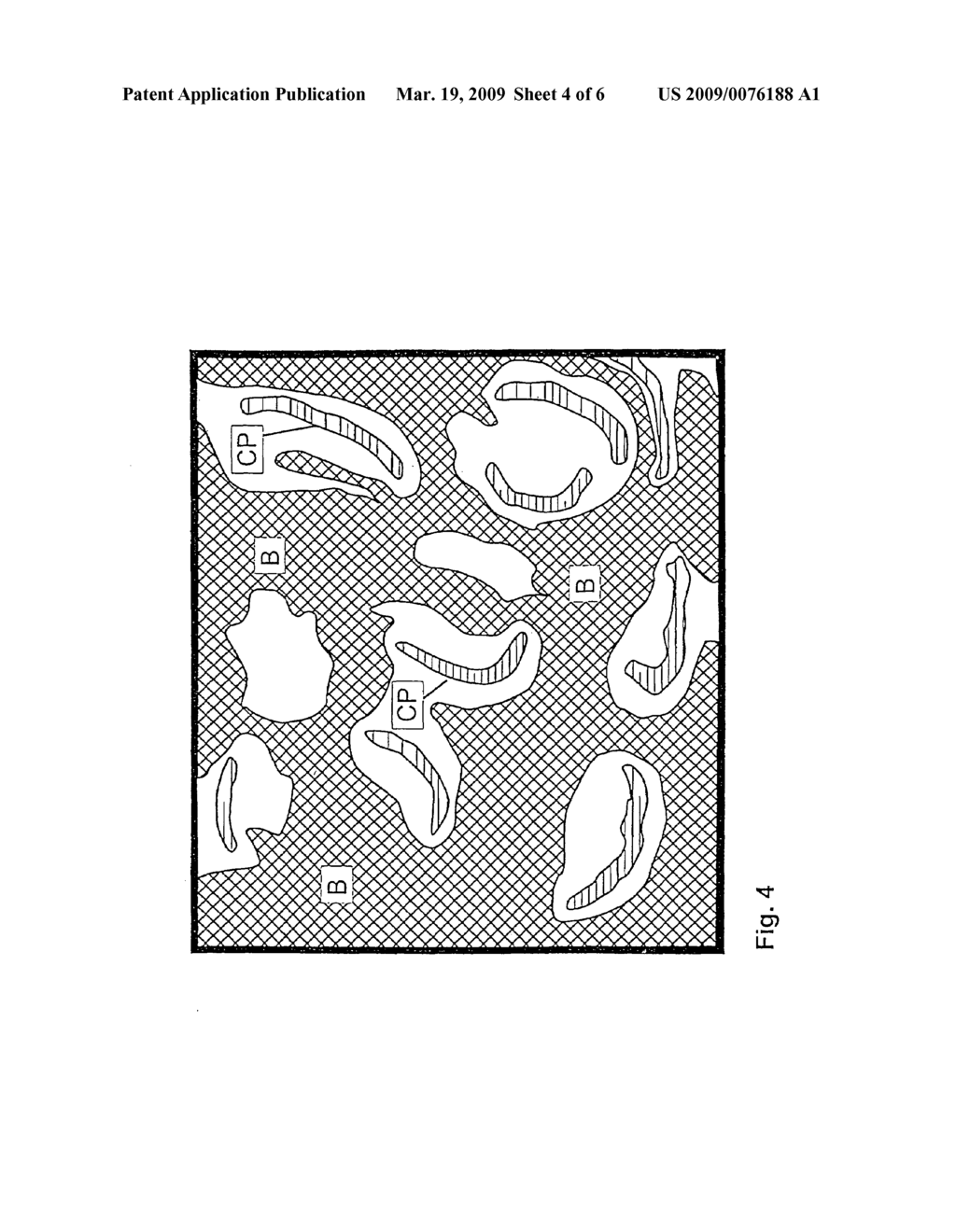 Polymer containing calcium sulfate particles for bone augmentation - diagram, schematic, and image 05