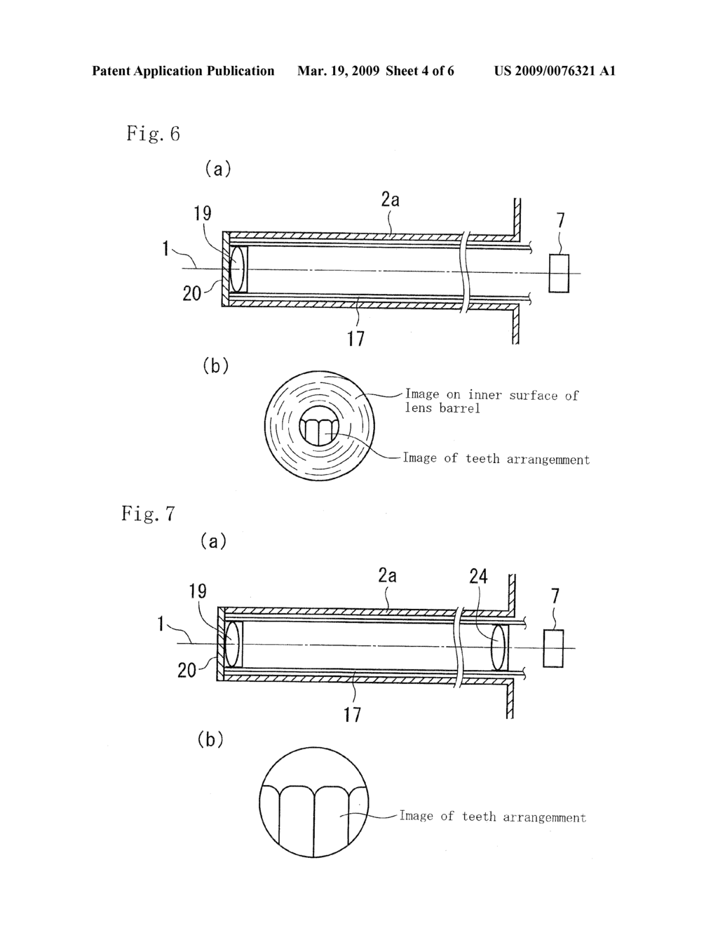 DIGITAL CAMERA FOR TAKING IMAGE INSIDE ORAL CAVITY - diagram, schematic, and image 05