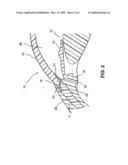 OCULAR IMPLANTS WITH DEPLOYABLE STRUCTURE diagram and image