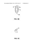 OCULAR IMPLANTS WITH DEPLOYABLE STRUCTURE diagram and image