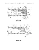 OCULAR IMPLANTS WITH DEPLOYABLE STRUCTURE diagram and image