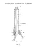 Method for treating a sphincter diagram and image