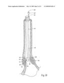 Method for treating a sphincter diagram and image