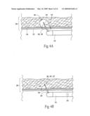 Method for treating a sphincter diagram and image