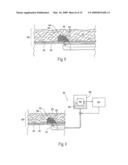 Method for treating a sphincter diagram and image