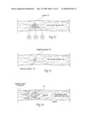 Method for treating a sphincter diagram and image