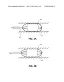 Methods and devices for eluting agents to a vessel diagram and image